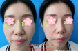 玻尿酸，还有这些你知道不？