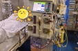 【卓越医疗】糖尿病引发致命危机！重症医学科上演37小时生死大营救