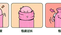 暑期“小丁丁”变形记：割还是不割？看完这篇不再纠结