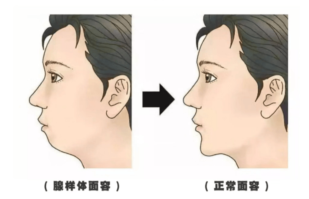 耳鼻喉科普.png