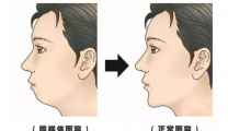 暑期耳鼻咽喉类疾病迎高峰！这篇家长必看